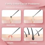 Acne Needle Blackhead Remover Pimple Blemish Comedone Extractor Tweezer Tool Kit - Image 4