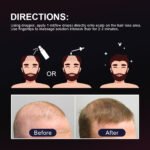 Finally Hair Regrowth Spray or Dropper with 5% Minoxidil Biotin Collagen - Image 6