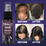 Finally Hair Regrowth Spray or Dropper with 5% Minoxidil Biotin Collagen - Image 7