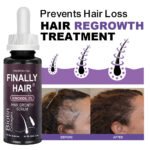 Finally Hair Regrowth Spray or Dropper with 5% Minoxidil Biotin Collagen - Image 9